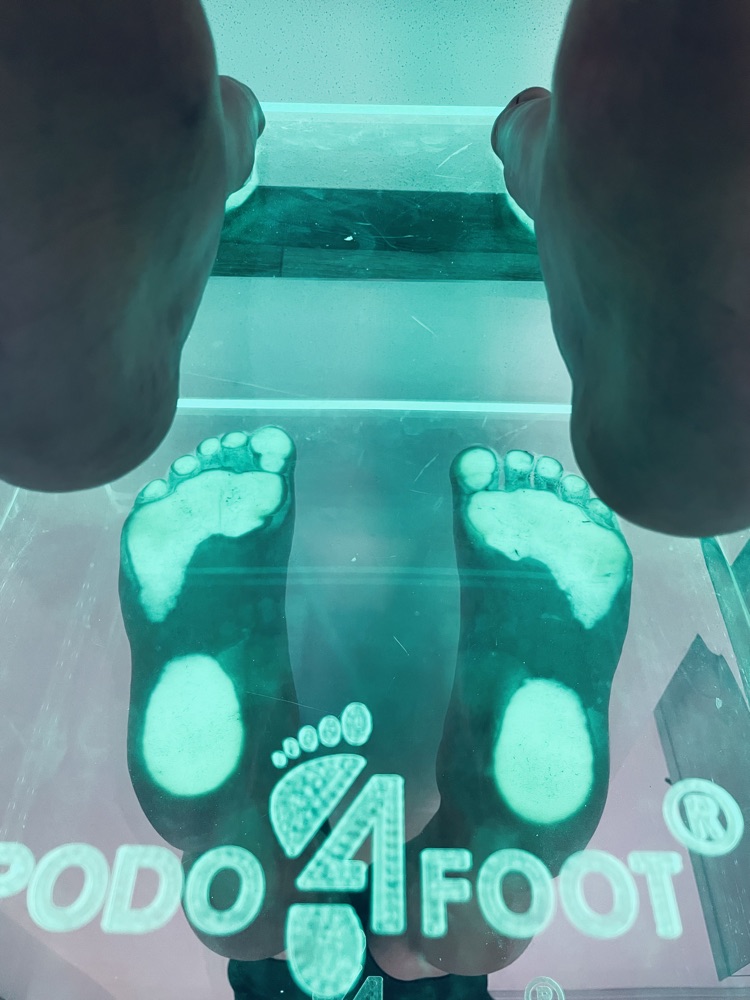 Vyšetrenie chodidiel na podoskope Podo4Foot